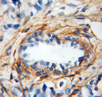 Gelsolin Antibody in Immunohistochemistry (Paraffin) (IHC (P))