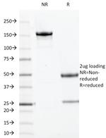 Topoisomerase (DNA) I, Mitochondrial (TOP1MT) Antibody in SDS-PAGE (SDS-PAGE)