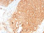 Topoisomerase I, Mitochondrial (TOP1MT) Antibody in Immunohistochemistry (Paraffin) (IHC (P))