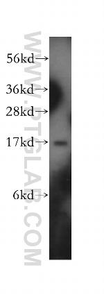 EIF1AX Antibody in Western Blot (WB)