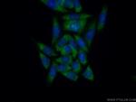 EIF1AX Antibody in Immunocytochemistry (ICC/IF)