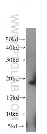 EIF1AX Antibody in Western Blot (WB)