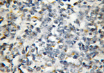 AP4M1 Antibody in Immunohistochemistry (Paraffin) (IHC (P))