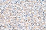 AP4M1 Antibody in Immunohistochemistry (Paraffin) (IHC (P))