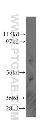 AP4M1 Antibody in Western Blot (WB)