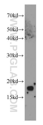 CPI17 Antibody in Western Blot (WB)