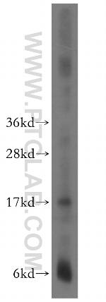 CPI17 Antibody in Western Blot (WB)