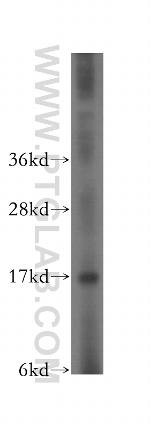 CPI17 Antibody in Western Blot (WB)