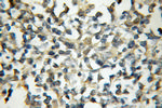 MALT1 Antibody in Immunohistochemistry (Paraffin) (IHC (P))