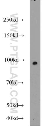 MALT1 Antibody in Western Blot (WB)