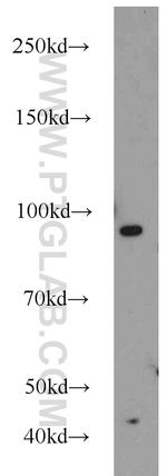 MALT1 Antibody in Western Blot (WB)