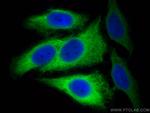 RRM2 Antibody in Immunocytochemistry (ICC/IF)