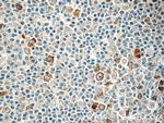 RRM2 Antibody in Immunohistochemistry (Paraffin) (IHC (P))