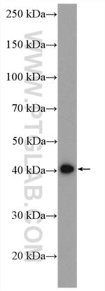 RRM2 Antibody in Western Blot (WB)