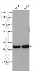 RRM2 Antibody in Western Blot (WB)