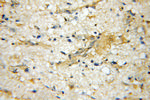 VPS52 Antibody in Immunohistochemistry (Paraffin) (IHC (P))