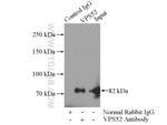 VPS52 Antibody in Immunoprecipitation (IP)