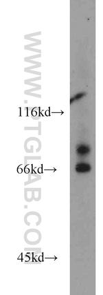 VPS52 Antibody in Western Blot (WB)