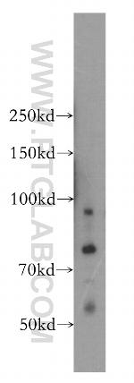 VPS52 Antibody in Western Blot (WB)