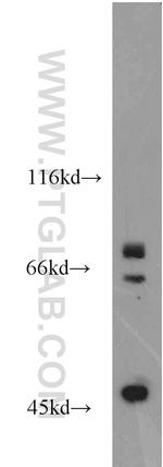 VPS52 Antibody in Western Blot (WB)