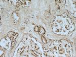 VDAC2 Antibody in Immunohistochemistry (Paraffin) (IHC (P))