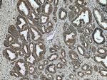 VDAC2 Antibody in Immunohistochemistry (Paraffin) (IHC (P))