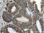 VDAC2 Antibody in Immunohistochemistry (Paraffin) (IHC (P))