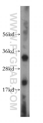 VDAC2 Antibody in Western Blot (WB)