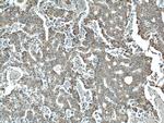 WSB1 Antibody in Immunohistochemistry (Paraffin) (IHC (P))