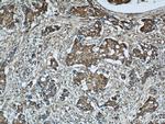 WSB1 Antibody in Immunohistochemistry (Paraffin) (IHC (P))