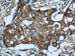 WSB1 Antibody in Immunohistochemistry (Paraffin) (IHC (P))