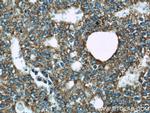 WSB1 Antibody in Immunohistochemistry (Paraffin) (IHC (P))