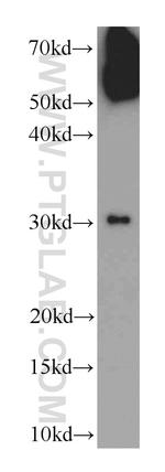 WSB1 Antibody in Western Blot (WB)