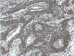 RAB1A Antibody in Immunohistochemistry (Paraffin) (IHC (P))