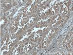 RAB1A Antibody in Immunohistochemistry (Paraffin) (IHC (P))