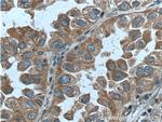 RAB1A Antibody in Immunohistochemistry (Paraffin) (IHC (P))