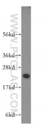 RAB1A Antibody in Western Blot (WB)