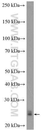 RAB1A Antibody in Western Blot (WB)