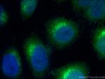 ARF4 Antibody in Immunocytochemistry (ICC/IF)