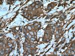 ARF4 Antibody in Immunohistochemistry (Paraffin) (IHC (P))