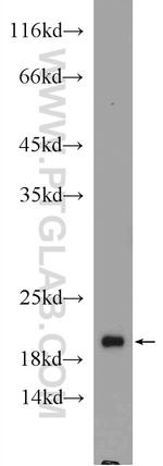 ARF4 Antibody in Western Blot (WB)