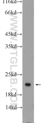 ARF4 Antibody in Western Blot (WB)