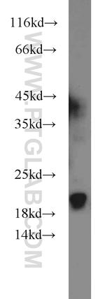 ARPP-19 Antibody in Western Blot (WB)