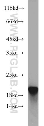 ARPP-19 Antibody in Western Blot (WB)