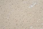 ARPP-19 Antibody in Immunohistochemistry (Paraffin) (IHC (P))