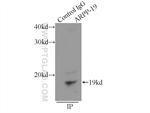 ARPP-19 Antibody in Immunoprecipitation (IP)