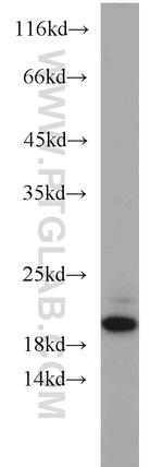 ARPP-19 Antibody in Western Blot (WB)