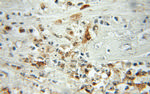 Profilin 1 Antibody in Immunohistochemistry (Paraffin) (IHC (P))