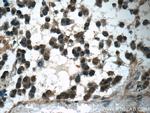 PARK7/DJ-1 Antibody in Immunohistochemistry (Paraffin) (IHC (P))