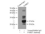 PARK7/DJ-1 Antibody in Immunoprecipitation (IP)